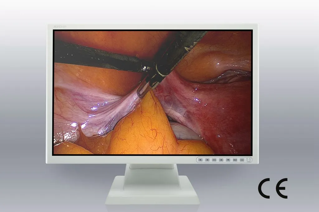 (JUSHA-ES26P) 26 Inch Endoscopic & Surgical Medical Display