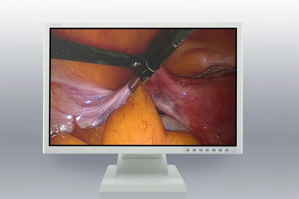 (JUSHA-ES26P) Endoscopic & Surgical Medical Display