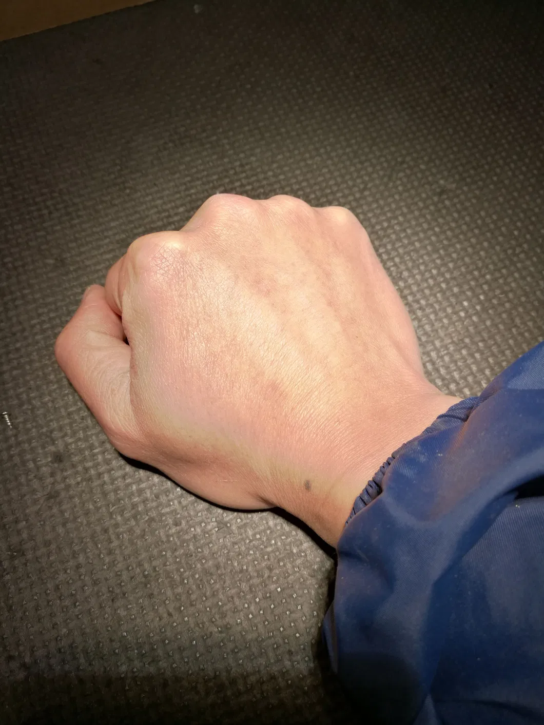 Easywell 6W LED Ks-La-6D Light Touch Examination Light for Minor Surgery with Ce, ISO