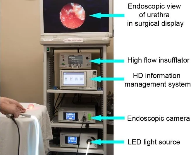 Electronic Endoscopy Tower Machine for Gynecology