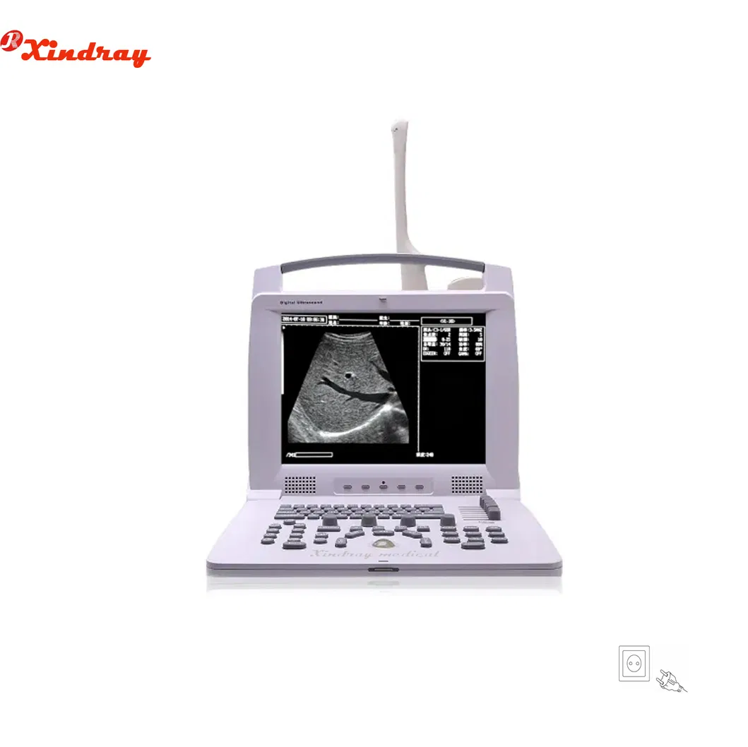 Factory Price Hospital Medical Equipment Animal Handheld Vet Color Doppler Portable Veterinary Ultrasound Scanner