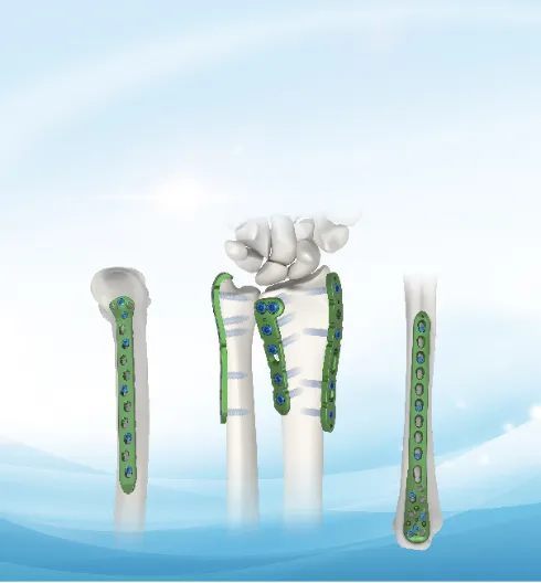 Hot Selling Upper Limb External Fixator Instrument Boxes