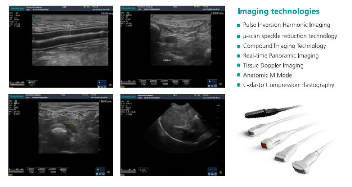 Medical Equipment Portable Color Doppler Ultrasound Sonoscape Veterinary S9V