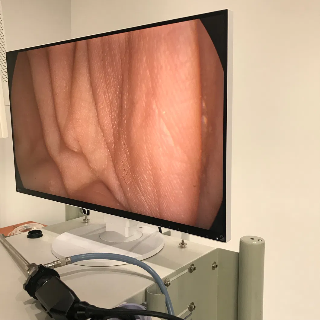 Mt Medical High Quality Abdominal Endoscopy System Laparoscopy Tower Equipment