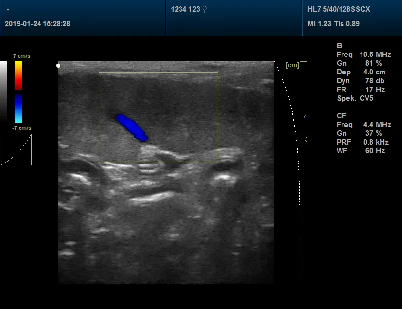 Pet Clinic Veterinary Color Doppler Ultrasound Scanner 3D, 4D