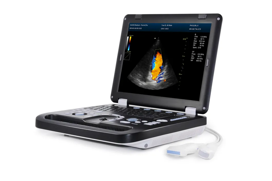 Pet Clinic Veterinary Color Doppler Ultrasound Scanner 3D, 4D