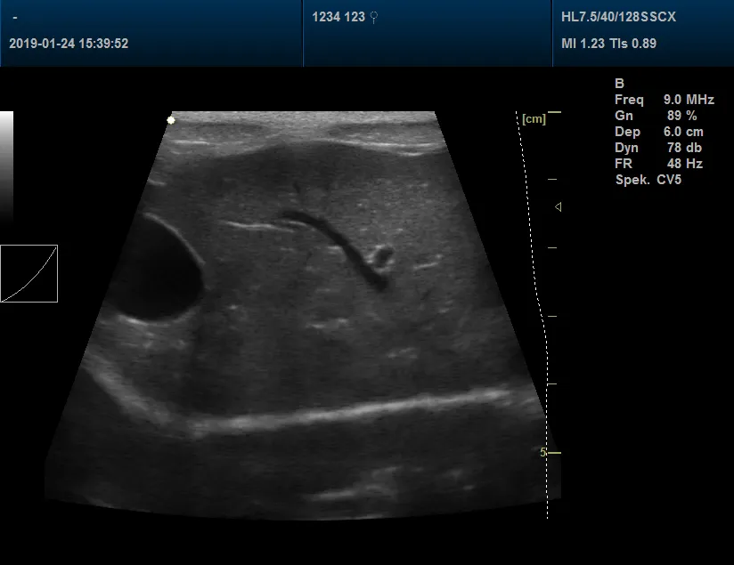 Pet Clinic Veterinary Color Doppler Ultrasound Scanner 3D, 4D