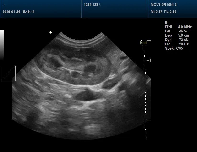 Pet Clinic Veterinary Color Doppler Ultrasound Scanner 3D, 4D