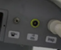 Superstar S1100 ICU Ventilator