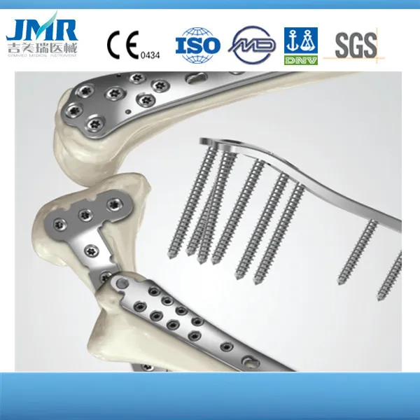 Titanium Orthopedic Implant Trauma Bone Plate Pfna Proximal Femoral Intramedullary Nail Antirotation