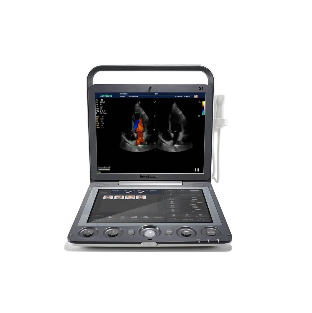 Touch Screen Sonoscape S9V Colour Doppler Veterinary Ultrasound