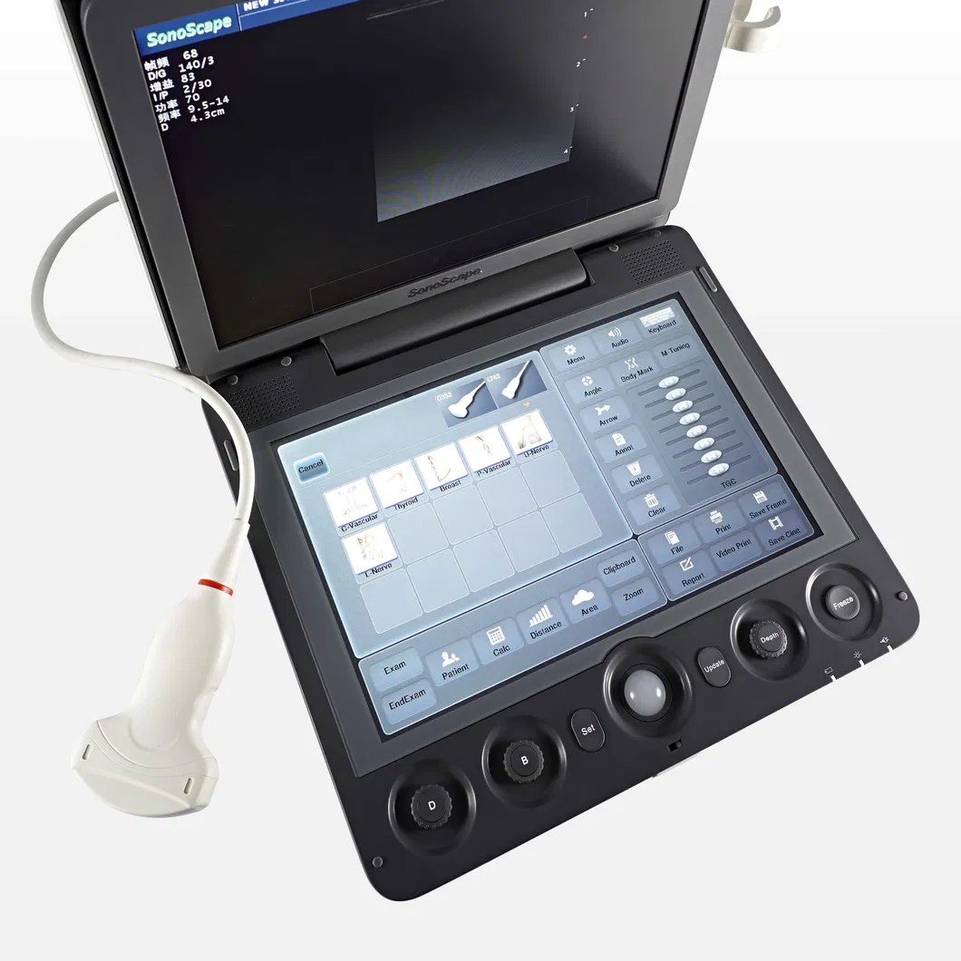 Touch Screen Sonoscape S9V Colour Doppler Veterinary Ultrasound