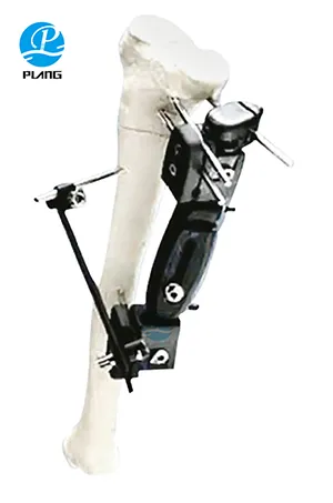 Xcaliber External Ortho Fix Radiolucent Tibia Fixator Sterile